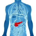 Definição Câncer de pâncreas